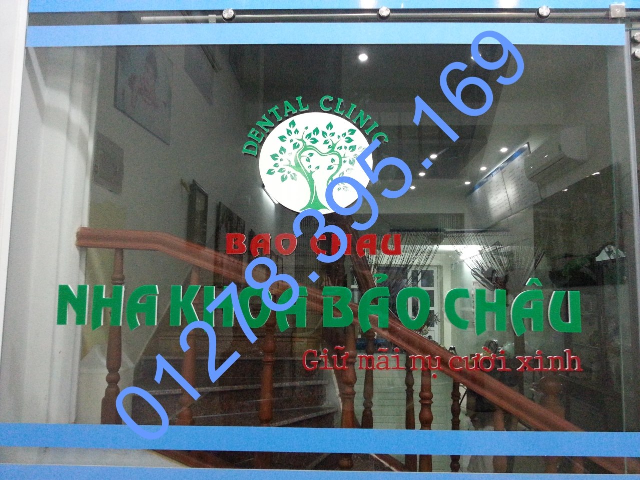 nha khoa bao chau 04